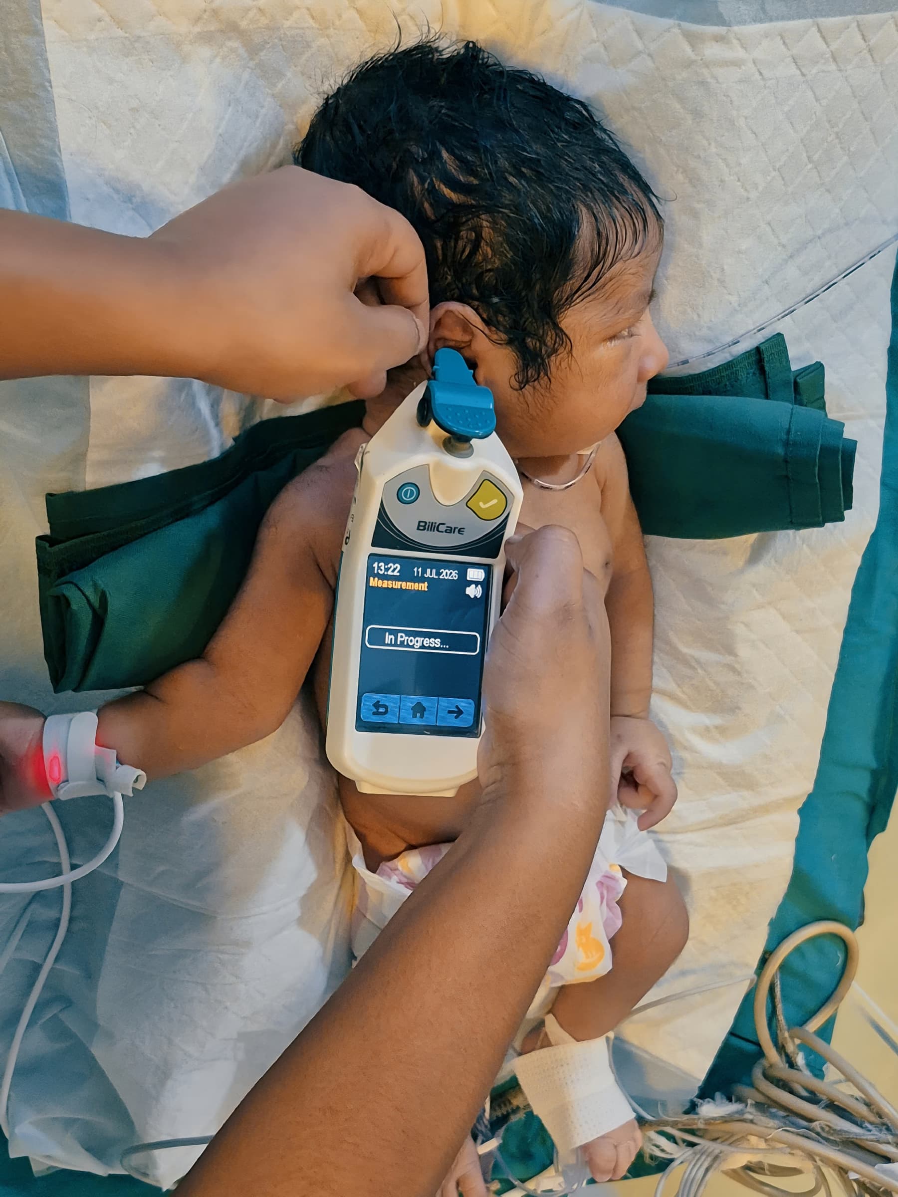 Bilirubin Testing