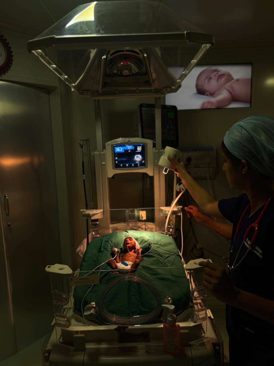 Giraffe Warmer NICU