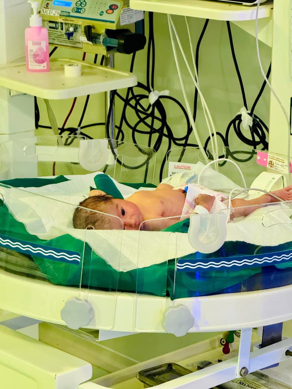 Newborn NICU